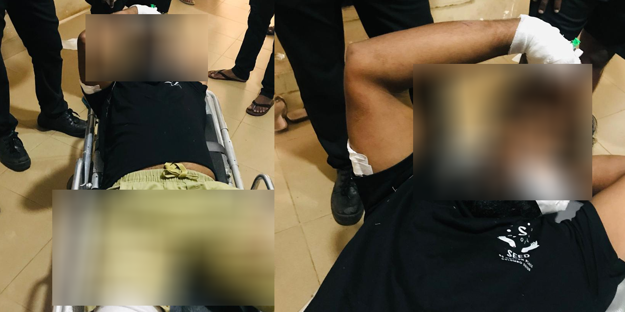 මිනුවන්ගොඩදී වෙඩි කෑ පුද්ගලයාගේ තොරතුරු රැසක් එළියට මිනුවන්ගොඩදී වෙඩි කෑ පුද්ගලයාගේ තොරතුරු රැසක් එළියට